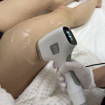 Лазерная эпиляция
                    Студия лазерной эпиляции  Киев