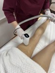 Лазерна епіляція - Знижки на комплекси до 40% Масажний салон  Київ
