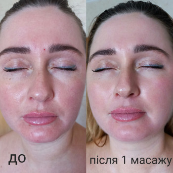 Масаж обличчя
                    Косметолог-эстетист Виктория Киев