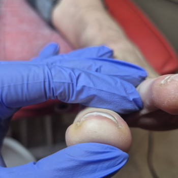 Лікування нігтів
                    Салон краси OH NAILS Одеса