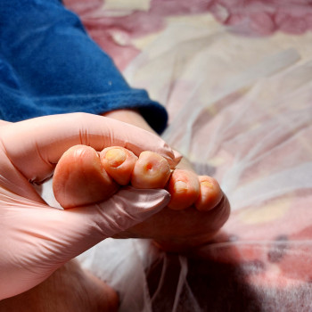 Лікування нігтів
                    Салон краси OH NAILS Одеса