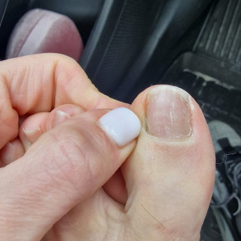 Лікування нігтів
                    Салон краси OH NAILS Одеса