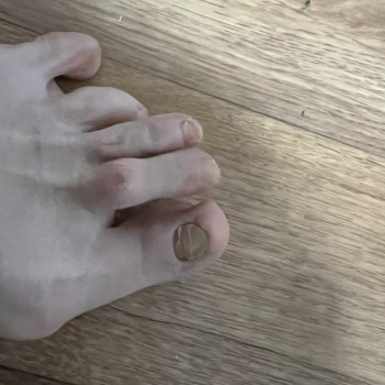 Лікування нігтів
                    Салон краси OH NAILS Одеса