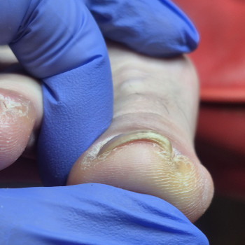 Лікування нігтів
                    Салон краси OH NAILS Одеса