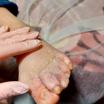 Обробка мозолі/натоптню
                    Салон красоты OH NAILS Одесса