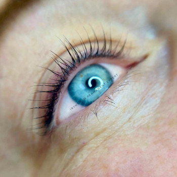 Міжвійка Light Touch