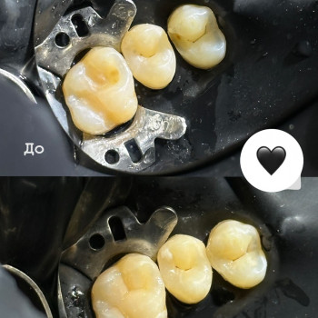 Надія Панчук, Вінниця Фото - 1