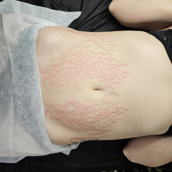 Марина Кобець, Кропивницкий Фото - 7