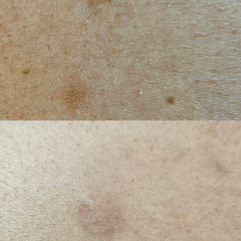 Марина Кобець, Кропивницкий Фото - 8