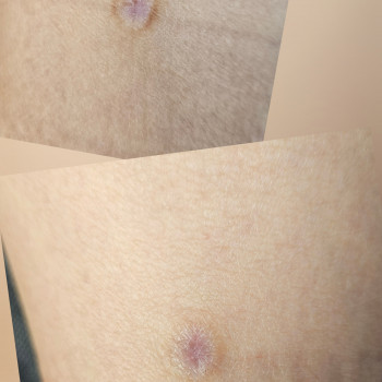 Марина Кобець, Кропивницкий Фото - 10