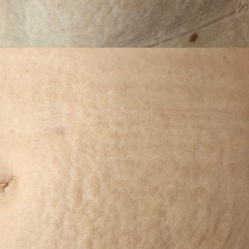 Марина Кобець, Кропивницкий Фото - 17