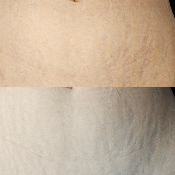 Марина Кобець, Кропивницкий Фото - 18