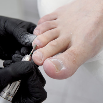 Фото из портфолио специалиста Владлена Харченко (подолог, Хмельницкий)