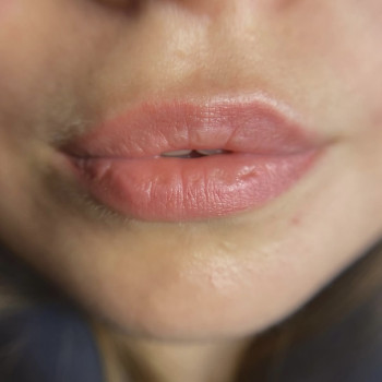 Перманент губ фото до
 
 
 