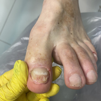 Надежда Чезганова, Черновцы Фото - 8