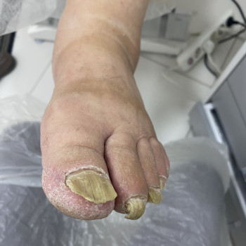 Надежда Чезганова, Черновцы Фото - 9