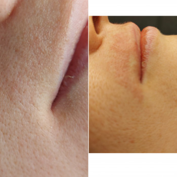 Наталія Дмитренко, Вінниця Фото - 6