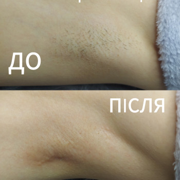 Наталія Дмитренко, Вінниця Фото - 7