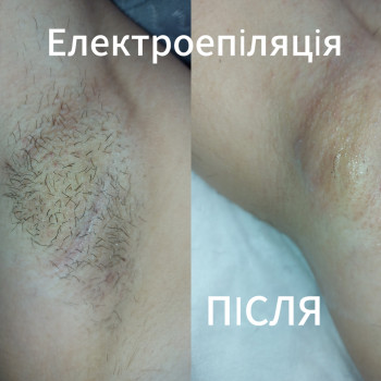 Наталія Дмитренко, Вінниця Фото - 8