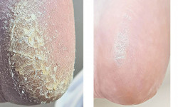 Педикюр медицинский Подолог Марьяна Киев