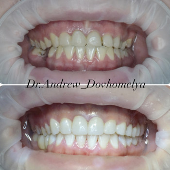 Андрій Довгомеля, Ужгород Фото - 2