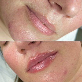 СТУДІЯ КРАСИ "Y&V”, Ирпень Фото - 20