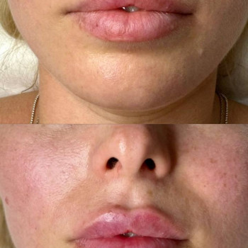 Мария Кіндра, Житомир Фото - 19