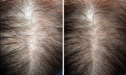 RRS XL HAIR Косметолог София Одеса