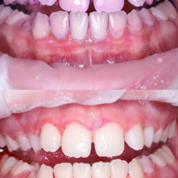 Стоматологическая клиника dental studio, Чернигов Фото - 5