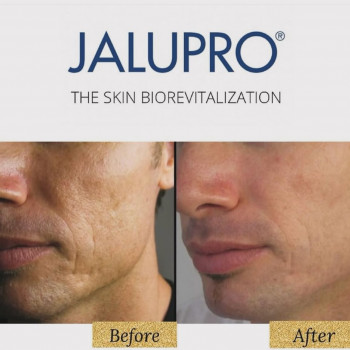 JALUPRO Classic 
                    Косметолог София Одесса