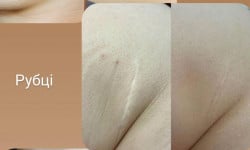 Мікронідлінг Тату салон Tattoo Code Черкаси