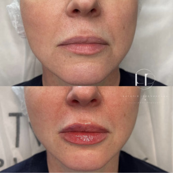 Наталія Рибчинська, Київ Фото - 1