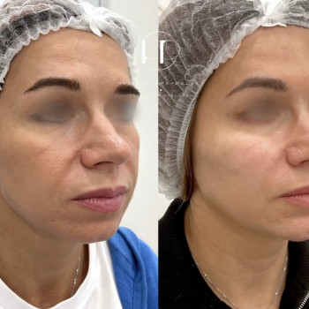 Наталія Рибчинська, Київ Фото - 3