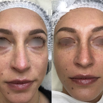 Наталія Рибчинська, Київ Фото - 6