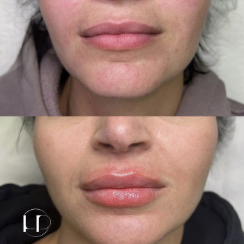 Наталія Рибчинська, Київ Фото - 7