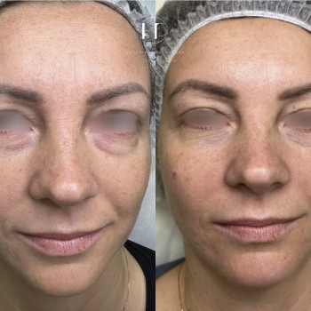 Наталія Рибчинська, Київ Фото - 9