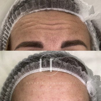 Наталія Рибчинська, Київ Фото - 10