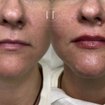 Наталія Рибчинська, Київ Фото - 12