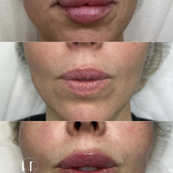 Наталія Рибчинська, Київ Фото - 14