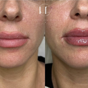 Наталія Рибчинська, Київ Фото - 15