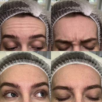 Наталія Рибчинська, Київ Фото - 17