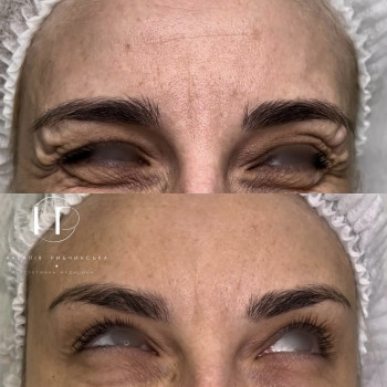 Наталія Рибчинська, Київ Фото - 18