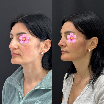 Абдель Эрритали, Київ Фото - 1