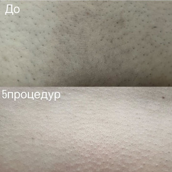 Lazer skin, Харків Фото - 6