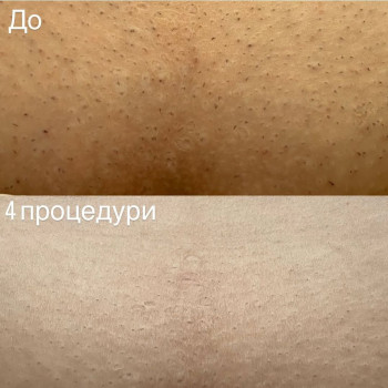 Lazer skin, Харків Фото - 7