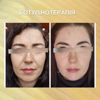 Coolbaba, Харьков Фото - 5