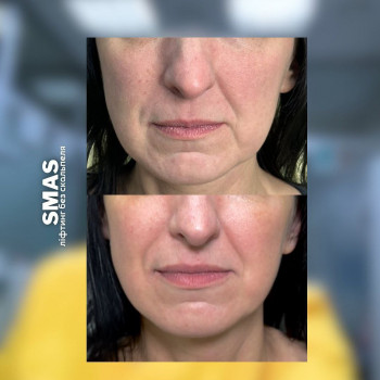 Coolbaba, Харьков Фото - 6