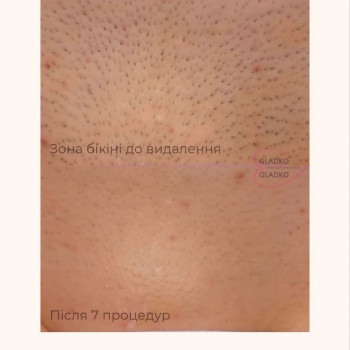 GLADKO GLADKO, Харків Фото - 5