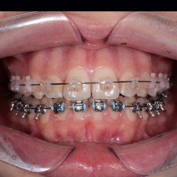 Фото з портфоліо фахівця Владислав Вячеславович Поник (ортодонт, Київ)