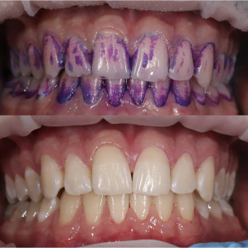 Фото з портфоліо фахівця Владислав Вячеславович Поник (ортодонт, Київ)